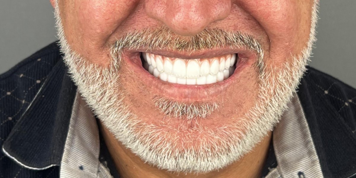 A Smile Rebuilt From Nothing - after